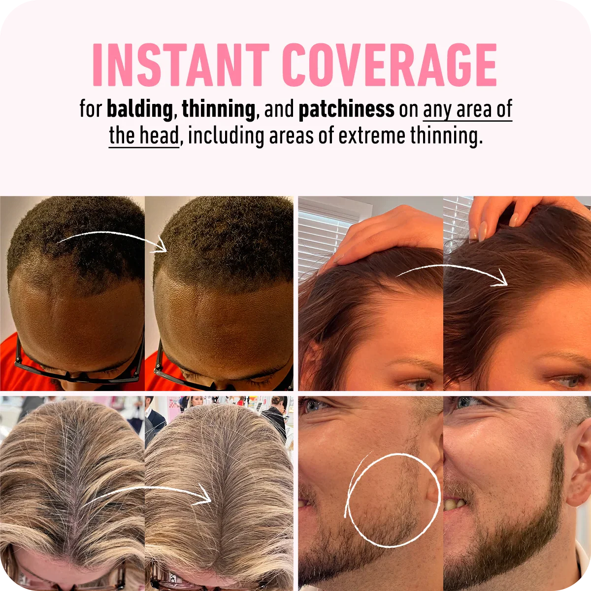 [Limited Time Offer] Magic Hair - Instant Result