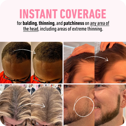 [Limited Time Offer] Magic Hair - Instant Result